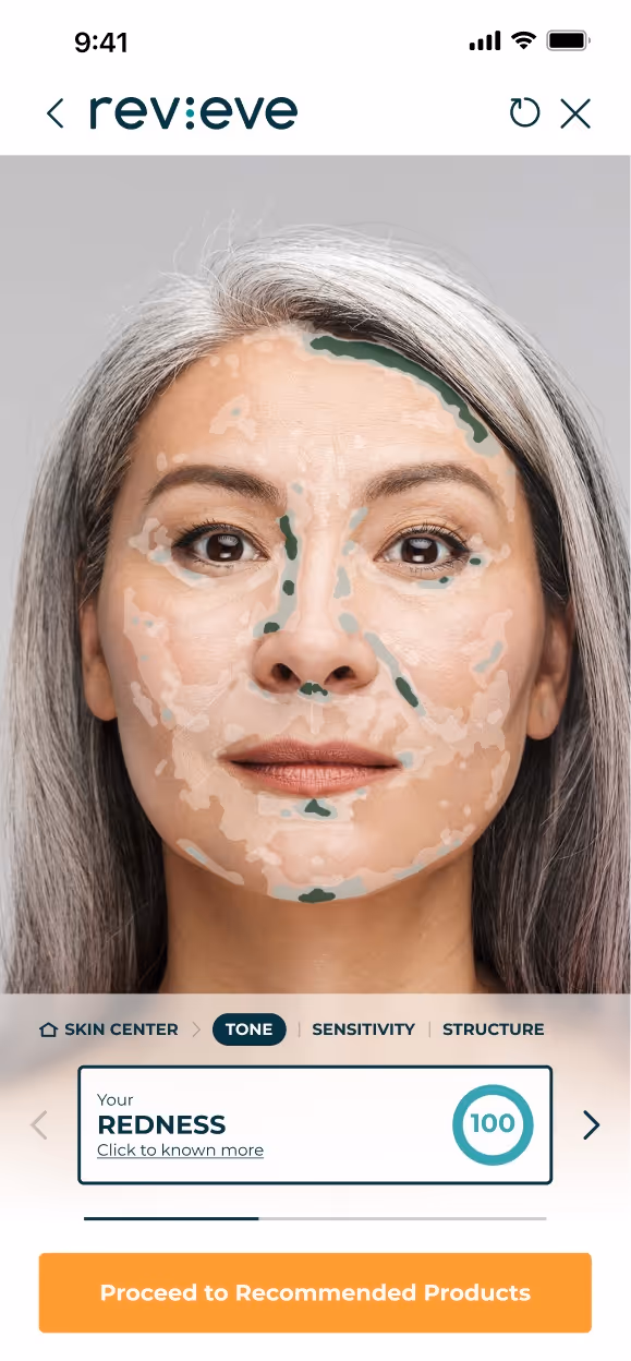 AI-powered selfie analysis screen highlighting a redness skin metric.