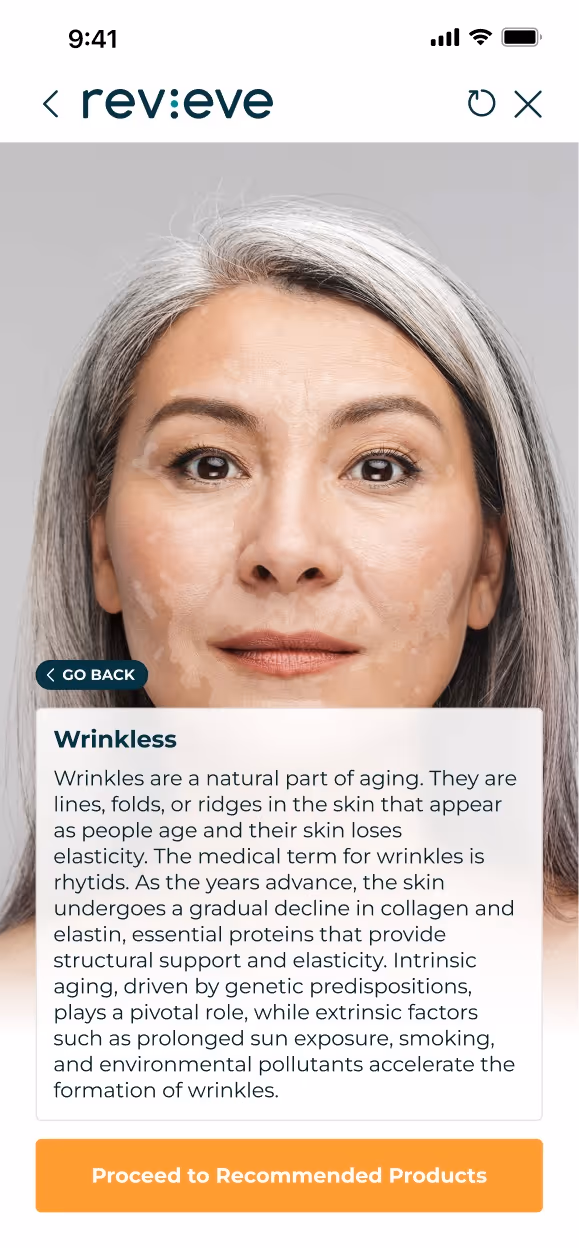 Educational storytelling screen explaining wrinkles as a skin metric to the user.